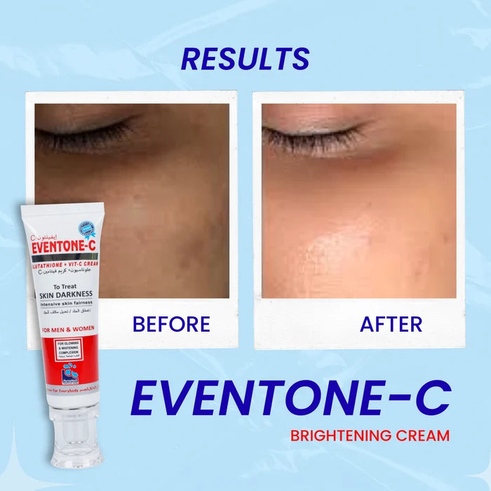 Eventone C Cream (Skin Glowing)