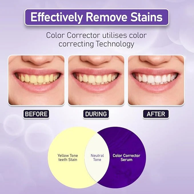 HiSmile V34 Colour Corrector – Purple Teeth Whitening Serum